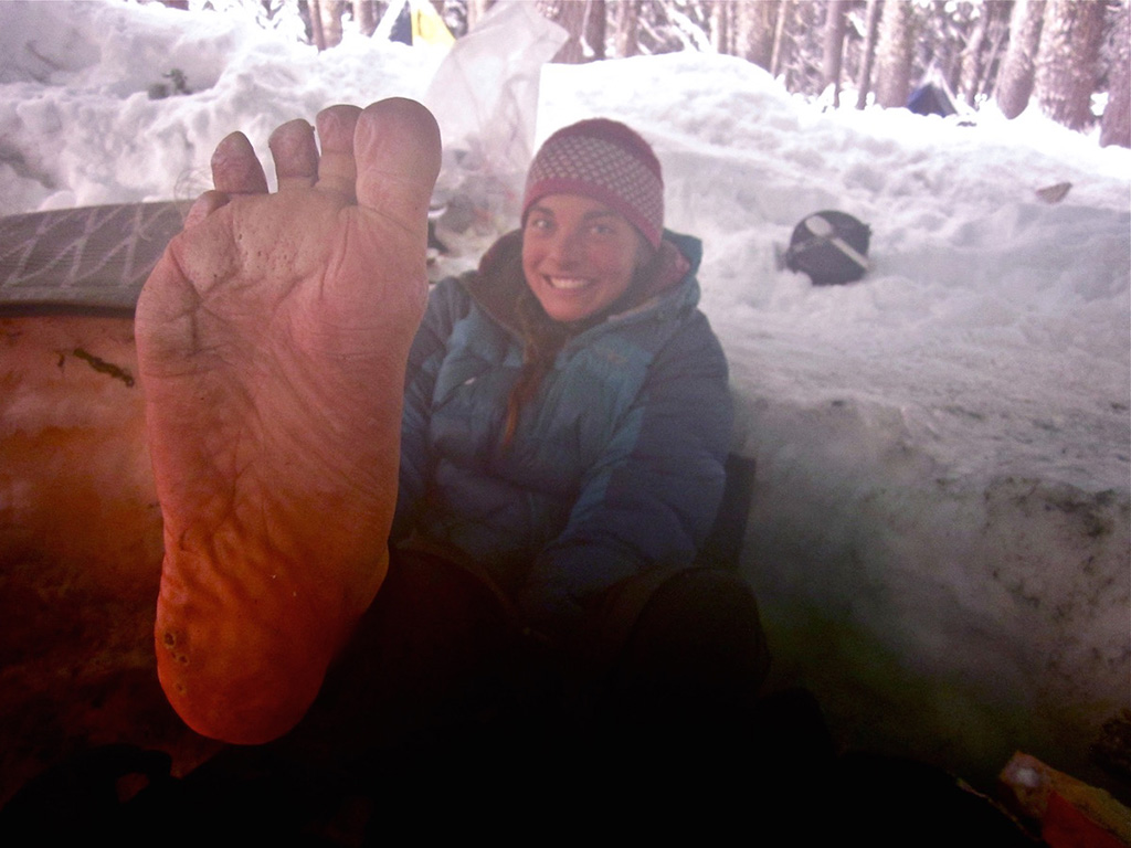 foot care on backcountry trip
